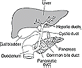 Environmental Causes of Gallstones