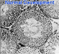 sperm-norml2.jpg (44544 bytes)